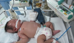 Sự thật về bé hoại tử cả bàn tay sau tiêm lao