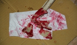 Nguyên nhân thịt lợn luộc biến thành màu đỏ bất thường