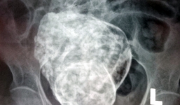 Nóng từ địa phương ngày 24/3: Khánh Hòa - Cụ bà 76 tuổi mang thai