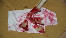 Tìm ra nguyên nhân thịt lợn chín thành màu đỏ