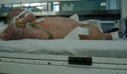 Vụ cháu bé hoại tử tay: Chưa thể đưa ra kết luận chính thức