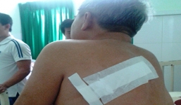 Cựu chiến binh bị côn đồ xông vào nhà chém trọng thương