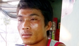 Phạt vạ Phó Công an xã vì...dám cạo gió cứu vợ mình