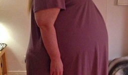 Lầm tưởng mang bầu vì khối u 32 kg trong bụng