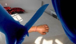 Nổi cơn ghen, người phụ nữ chém đứt tay tình địch