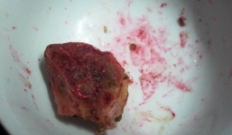 Nghệ An: Thịt lợn chín chuyển màu đỏ bất thường