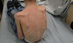 Bố và mẹ kế bạo hành, nhốt cậu bé 5 tuổi trong tủ quần áo