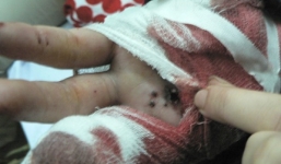 Bưu phẩm gửi giám đốc phát nổ, kế toán “dính” hàng chục viên đạn chì