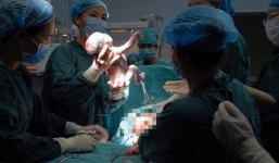 Cận cảnh một ca sinh 4 hiếm hoi