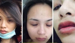 Hoa hậu Diễm Hương tung bằng chứng bị chồng cũ đánh đập