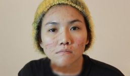 Phương Uyên: 'Sau lưng Anh Thúy là cả 1 êkíp'