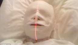 Bác sĩ biến nam thanh niên thành 'xác ướp Ai Cập' do chẩn đoán nhầm