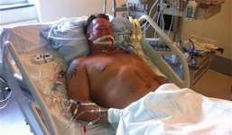 Nghe lỏm bác sĩ nói chuyện hiến tạng, bệnh nhân hôn mê sợ hãi tỉnh lại