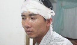 Một giám đốc bị đập cốc bia vào đầu, truy sát dã man