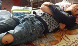 12 côn đồ la hét, tấn công kiểm lâm, cướp súng và tang vật