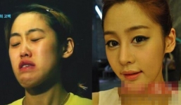 Vợ quá đẹp sau phẫu thuật thẩm mỹ, chồng rút đơn ly hôn