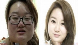 Vợ quá đẹp sau phẫu thuật thẩm mỹ, chồng rút đơn ly hôn