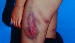 Công an triệu tập, mẹ kế độc ác 'biến' khỏi địa phương