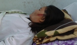 Bố chồng chém con dâu nhập viện