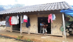 Tuổi thơ 'bị xích' của cô bé răng mọc ngược