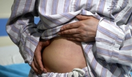 Kinh dị mô nâng ngực tụt xuống bụng và lưng