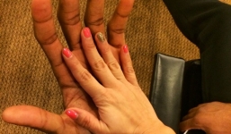 Người đàn ông có đôi bàn tay dài 30 cm