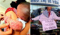 Dịch sởi, chuyện ăn cắp sách và thói ngụy biện nực cười