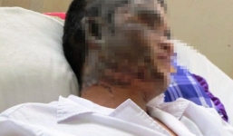 Kẻ lạ đột nhập, tạt axit lúc rạng sáng