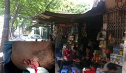 Hà Nội: Mâu thuẫn, nam thanh niên bị chém rách tai