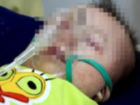 Nỗi đau của người cha bế đứa con bất động vì sởi 