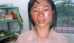 Nghi án chồng hành hạ vợ như thời trung cổ rồi ép uống thuốc sâu?