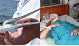 Cận cảnh loài cá nhái tấn công du khách ở Nha Trang