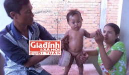 Cậu bé vừa sinh ra đã mang hình thù kỳ lạ