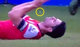 Cận cảnh tình huống bay 2 răng cửa của Mikel Arteta