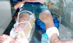 Cuộc giải cứu thanh niên bị cả nhà người yêu đánh gãy chân