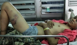 Bị cả nhà người yêu đánh nhập viện vì nghi 'hại đời con gái'