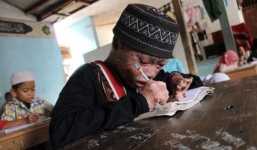 Cận cảnh cậu bé bị lột xác như rắn, mắt đỏ rực