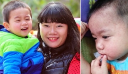 Dịch sởi:  Lo tự cứu con mình đi!