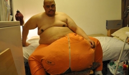 Cuộc sống của người đàn ông có túi tinh hoàn khổng lồ nặng hơn 60 kg