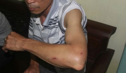 U50 bị chém xối xả vì nghi bắt cóc gái nhà lành