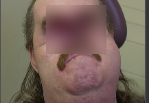 Rùng mình với hình ảnh người đàn ông không mặt