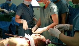 Thoát chết kỳ diệu khi bị thanh thép xuyên qua đầu