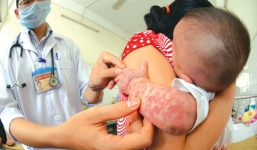 Thủ tướng yêu cầu xử lý nghiêm vụ Vinaphone 'kiếm tiền' từ dịch sởi