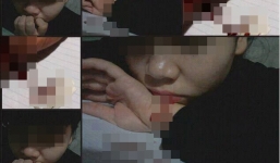 Bức ảnh Nữ sinh khóc lóc, tự rạch tay khiến dân mạng rùng mình