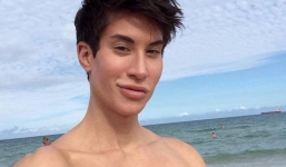 Những điều chưa biết về chàng trai búp bê Ken phẫu thuật 149 lần