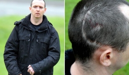 Người đàn ông không thể ngừng cười, ngay cả khi đang khóc