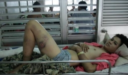 Bắt giam kẻ tra tấn, đánh gãy chân người yêu con gái