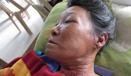 Một công an xã chết trong tư thế treo cổ