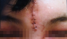 Ăn đêm ở cổng viện, 2 cô gái bị 10 thanh niên sàm sỡ