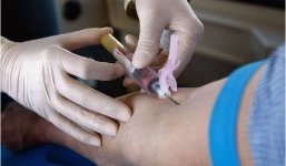 “Liệu pháp ma cà rồng” giúp cải lão hoàn đồng